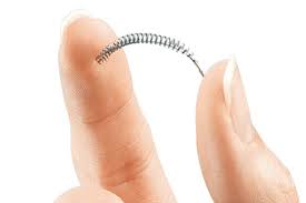 Essure Permanent Birth Control