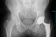 Clearwater Medical Malpractice Law Firm