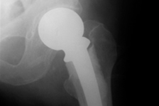 Tampa Medical Malpractice Lawyer